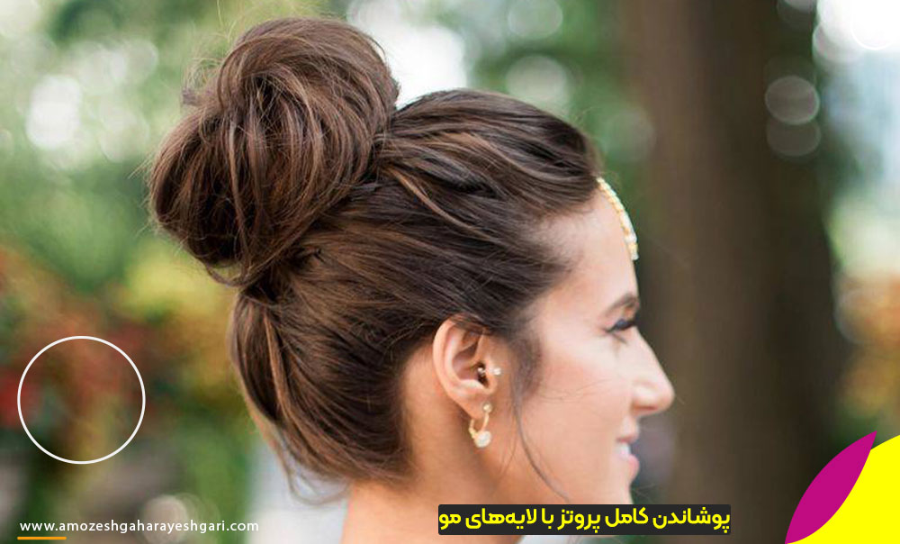 پوشاندن کامل پروتز با لایه‌های مو